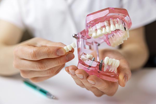 Modell von Zähnen